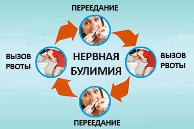 Лечение булимии в Васюринской